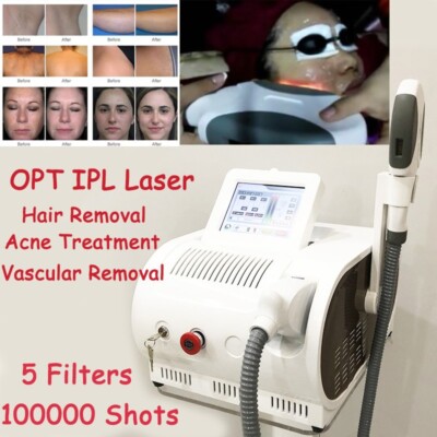 IPL Elight OPT Laser Body Hair Removal Acne Treatment Vascular Removal Machine