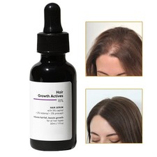 Hair Growth Liquid 30ml Thickening Lightweight Natural Thinning Hair Density
