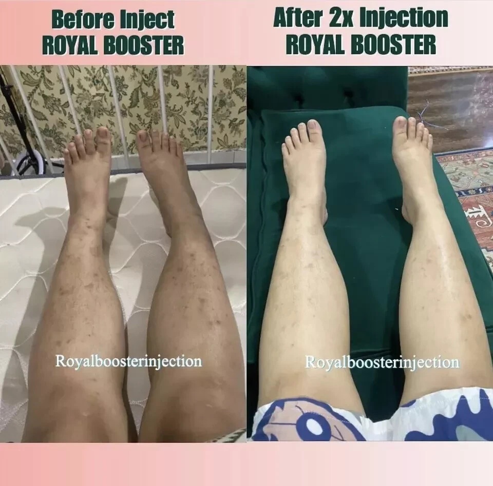 Royal Booster Skin Glutathione Whitening Full Body With Vitamin C DHL  Express