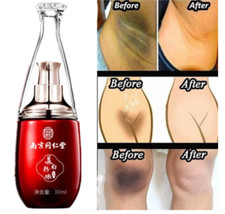 Crema Blanqueadora Para Partes Intimas Piel Axilas Todo El Cuerpo Muy Efectiva