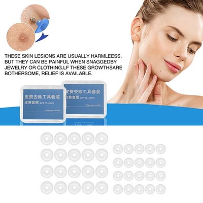 20Pcs Skin Tag Removal Rubber Bands Safe Micro Band Non Toxic Mole Wart Skin-y