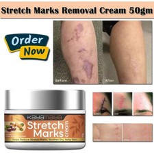 Scar Removal Cream Acne Surgery Burn Injury Scar Removal Cream 50gm
