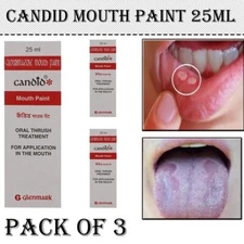 3 X Candid Mouth Pain For Oral Thrush Treatment For Kills Fungal Infection FS