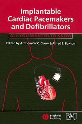 Implantable Cardiac Pacemakers and Defibrillators: All You Wanted to Know: Used