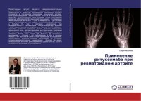 Primenenie Rituximaba Pri Rewmatoidnom Artrite Sofiq Awlohowa