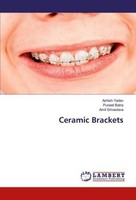 Ceramic Brackets Ashish Yadav
