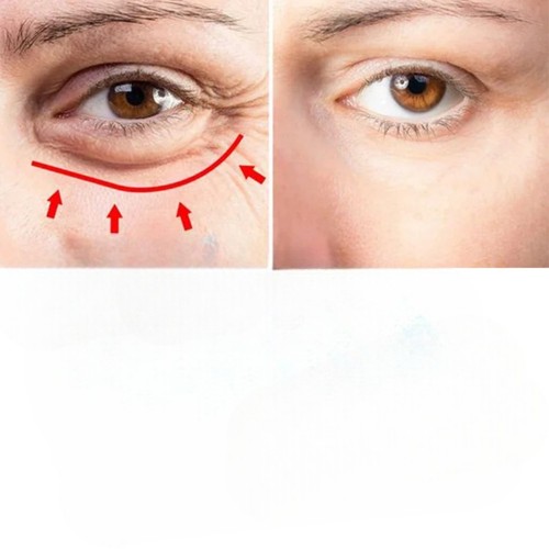 CAYMAN REPAIR & TREATMENT EYE CREAM by Vibrant Glamour, Awaken Tired Puffy Eyes - Picture 4 of 9