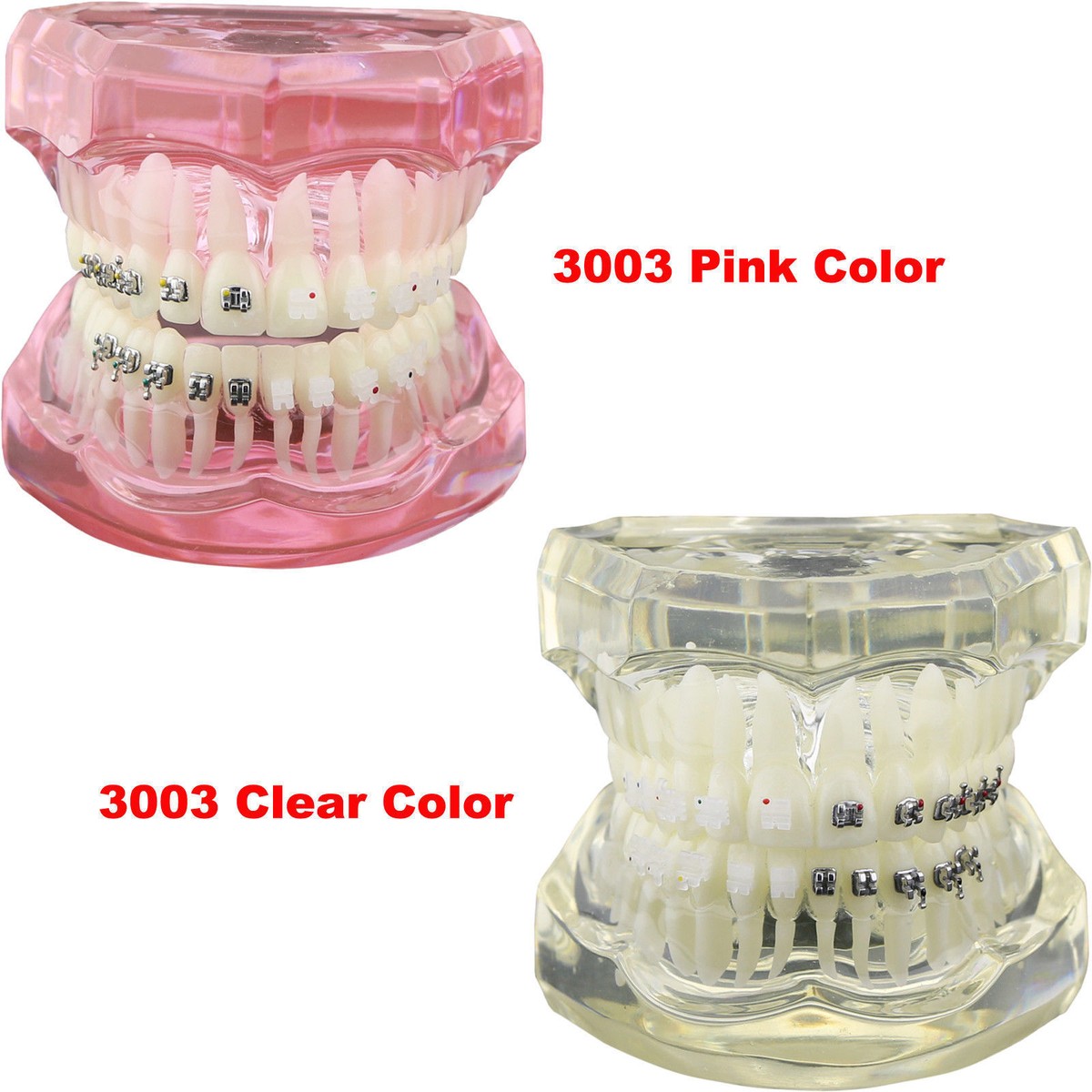 Dental Orthodontic Study Model With Metal Braces - Teeth Model For Demonstration & Training (Model 3003)