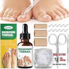 Ingrown Toenail Kit - Ingrown Toenail Drops, Ingrown Toenail Set - 60 Pcs