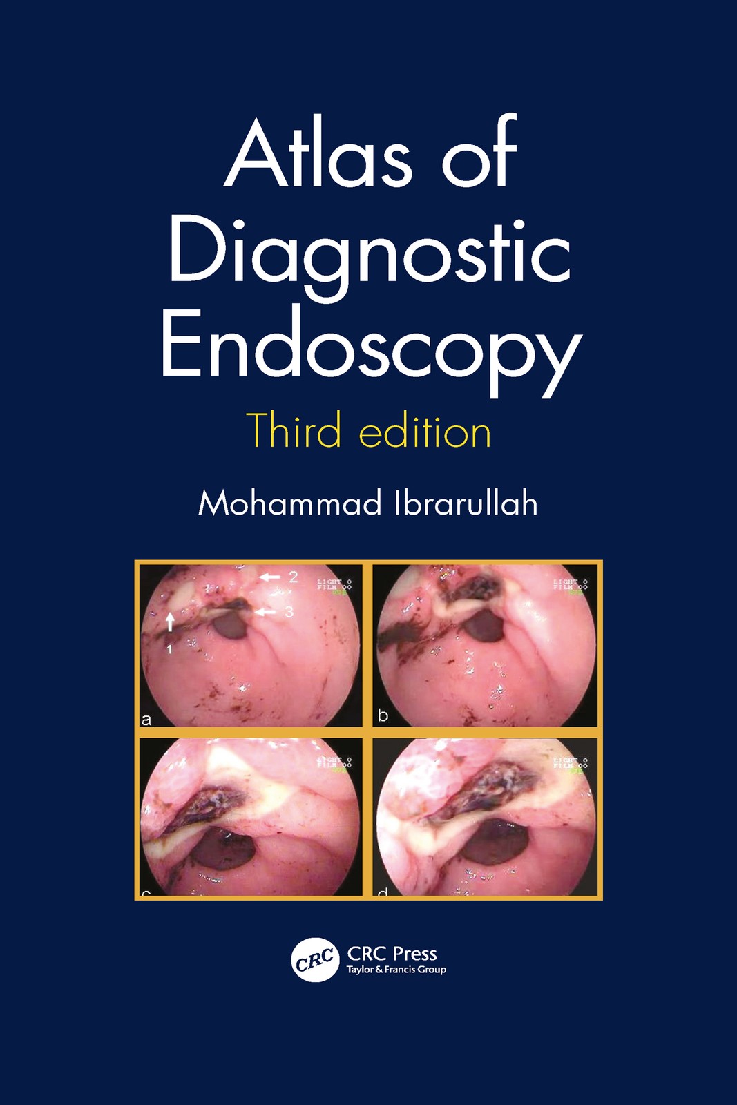 Atlas of Diagnostic Endoscopy, 3E - 3rd Edition