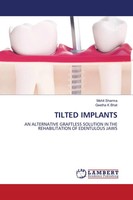 Tilted Implants Mohit Sharma (U. A.) Taschenbuch Englisch 2021 EAN 9786203863314