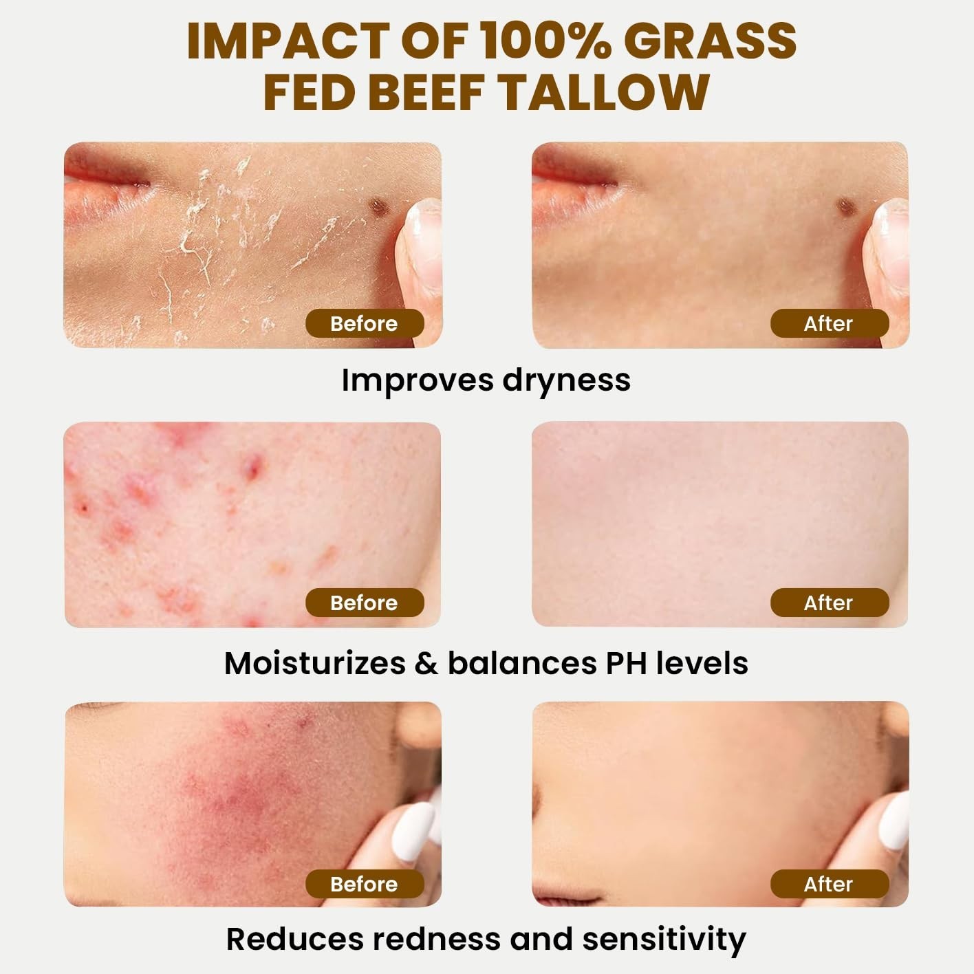 Beef Tallow for Skin - Organic Grass-Fed Whipped Beef Tallow and Honey Balm