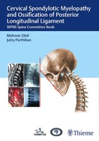 Cervical Spondylotic Myelopathy And Ossification Of Posterior Longitudinal...