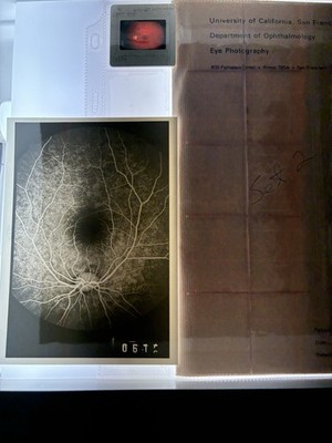 Ophthalmology Retina Eye Photography Slides Photos Neal White Archive UCSF