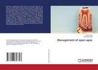 Saloni Tyagi (U. A.) | Management Of Open Apex | Taschenbuch | Englisch (2024)