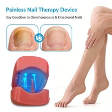 Nail Fungus Laser Treatment Device 460nm 905nm Blue Light Therapy for Toenails