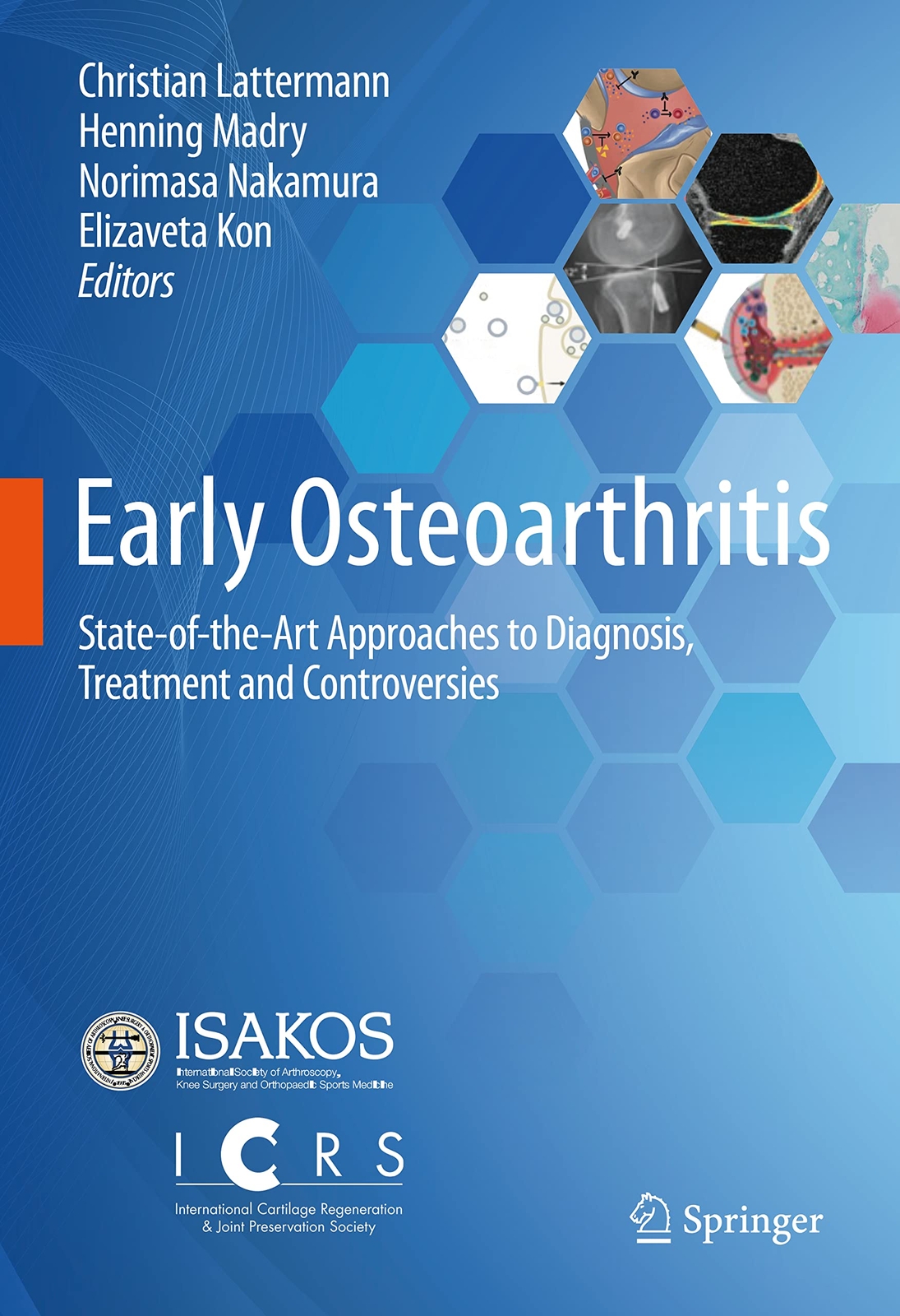 Early Osteoarthritis: State-of-the-Art Approaches to Diagnosis