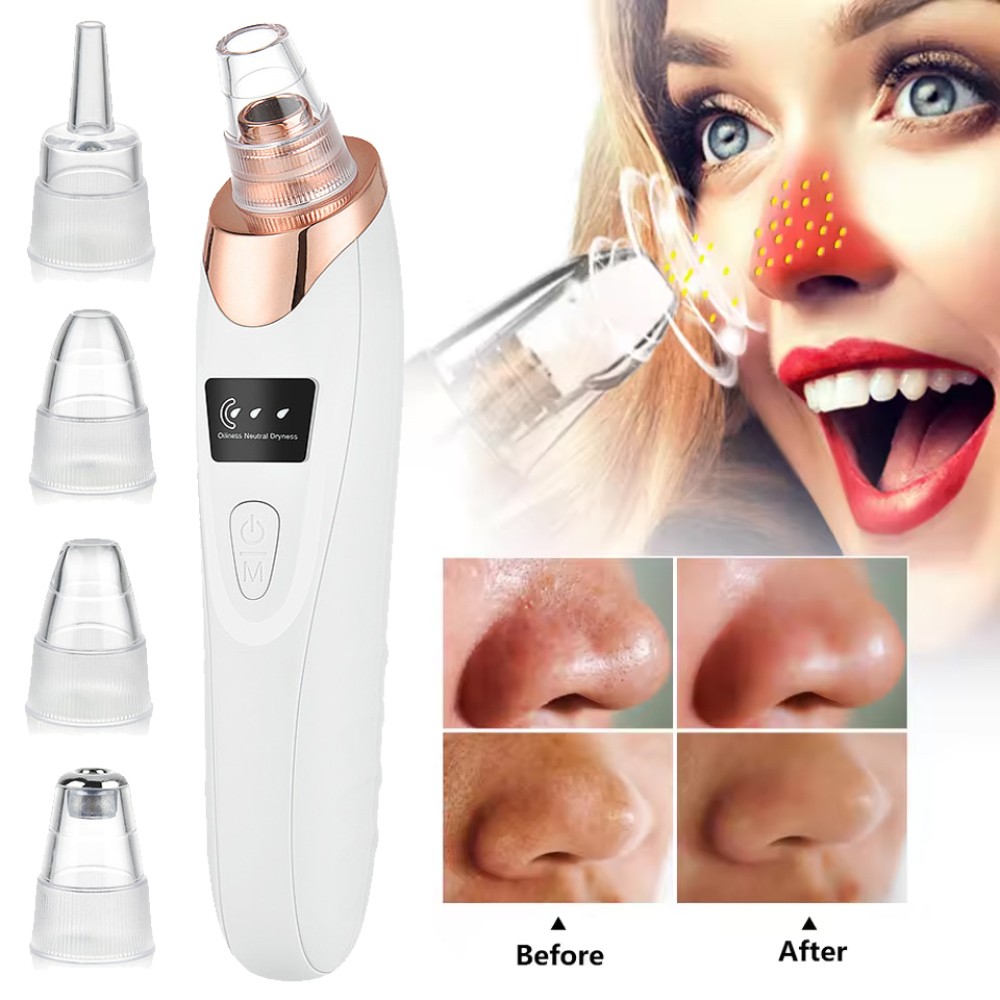 Blackhead Remover Electric Pore Nose Sucker Pimple Skin Acne Face Cleaner-Vacuum