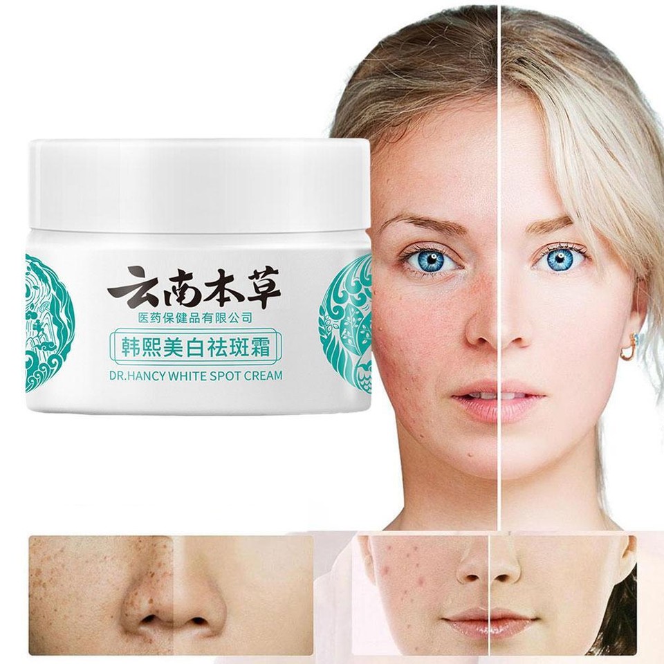Dr Hancy Face Whitening Spot Cream For Dark Skin Spots White Cream _н