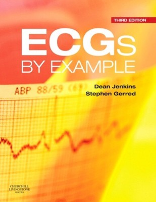 ECGs by Example by Dean Jenkins