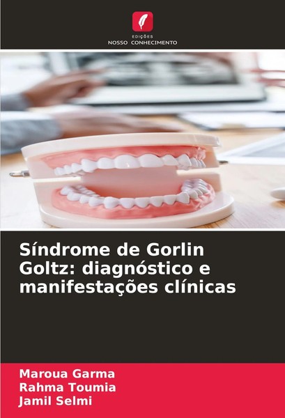 SíNdrome De Gorlin Goltz: DiagnóStico E ManifestaçõEs ClíNicas Garma (U. A.)-image