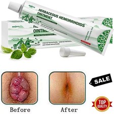 1 Mejores Crema Para Las Hemorroides Tu Puedes Liberarte Del Dolor Y Sangrado