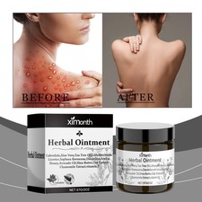 Skin Care Herb Ointment Relieve Dry, Itching and Red Skin