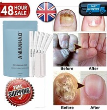 5X Pro Anti Fungal Nail Treatment Repair Finger Toe Care Nail Fungus Liquid Pen