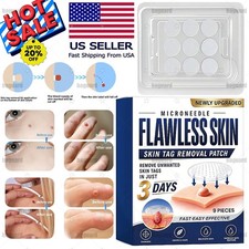 Skin Tag Remover Patches Quick Effective Mole and Wart Pad Removal Sticker US