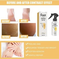 -_1-3X Spray Exfoliante de Pies, Spray Exfoliante de Pies Batido Hidratante Profundo Z1M7