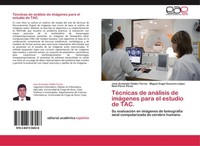 TéCnicas De AnáLisis De ImáGenes Para El Estudio De Tac. Miguel Angel Guevara Ló