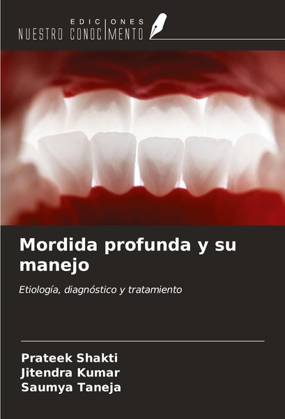 Mordida Profunda Y Su Manejo Prateek Shakti-image