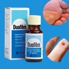 DUOFILM 15ml Salicylic Acid For Removing Plantar Warts Corns Calluses (EXP 2026)