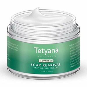 best old stretch mark removal cream