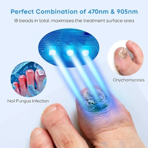Repair Fast Nails Fungus Repair Toenail Fingernail Removes Nail Fungus Foot Care - Picture 11 of 19