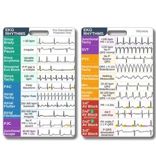 EKG Rhythm Interpretation Badge Card, Nursing Size, Color-coded