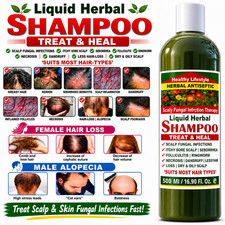 Scalp Fungal Infections Psoriasis Seborrhea - ANTISEPTIC HERBAL SHAMPOO 500 ML
