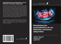 Anjana Thomas (U. A.) | RehabilitacióN ProstodóNtica De Los Defectos...