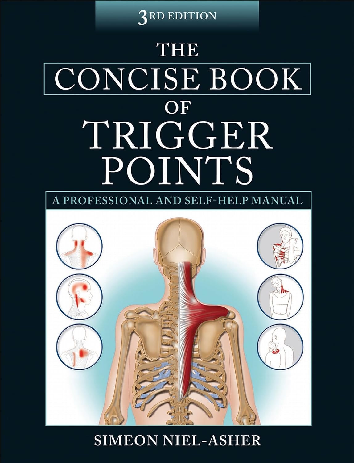 The Concise Book of Trigger Points by Simeon Niel-Asher (Paperback, 2014) - Image 3