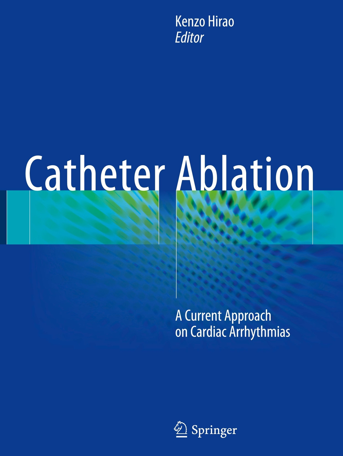 Thumbnail - Catheter Ablation | A Current Approach On Cardiac Arrhythmias | Kenzo