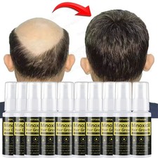 Minoxidil 5% Extra Strength Men Hair Regrowth Solution Treatment 10 Month Supply