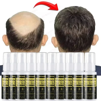 BOTASUN Minoxidil 5% Extra Strength Men Hair Regrowth Solution Treatment 10 Month Supply