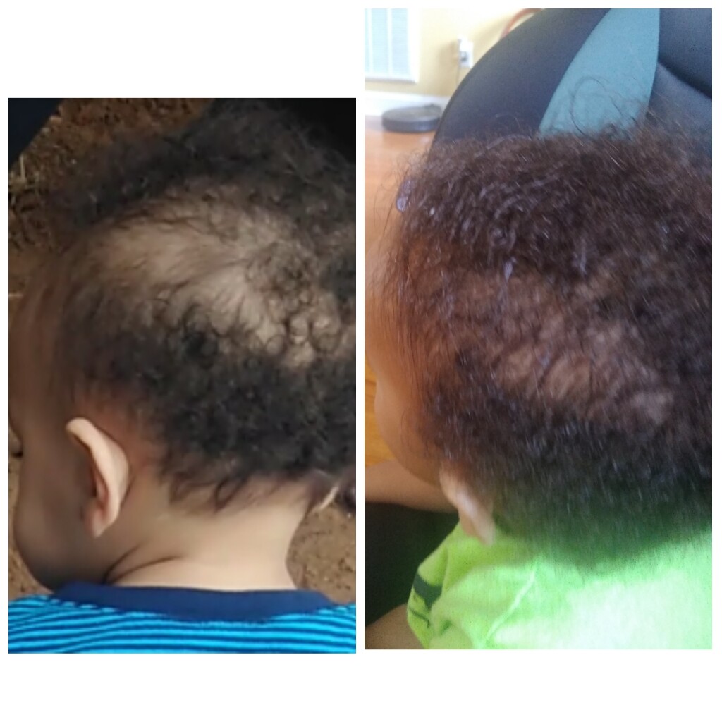 Organic Hair Growth Oil Serum treatment  1 oz. Alopecia,Bald Spots,Thinning hair