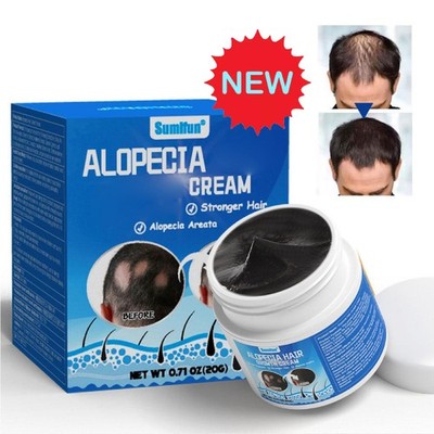 Alopecia Areata Care Set Hair Follicle Health Scalp REGROWTH HAIR Nourish HO T