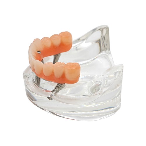 Multiple Types Dental Teeth Model Ortho Implant Practice Teaching Demo Model - Picture 272 of 276