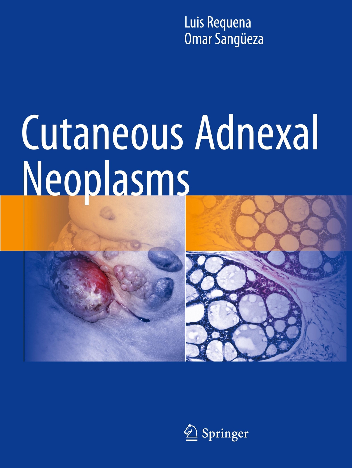 Thumbnail - Cutaneous Adnexal Neoplasms | Omar Sangüeza (u. A.) | Taschenbuch |