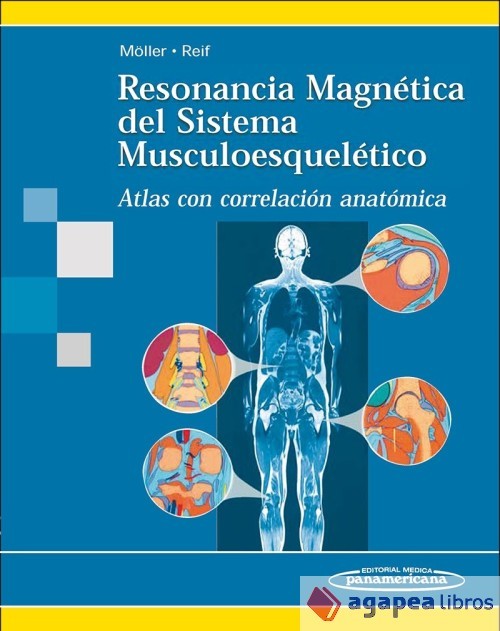 Resonancia Magnética del Sistema Musculoesquelético. Atlas con correlación anató