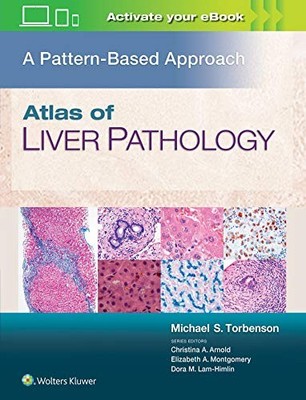 ATLAS OF LIVER PATHOLOGY: A PATTERN-BASED APPROACH By Torbenson Michael Md *VG+*