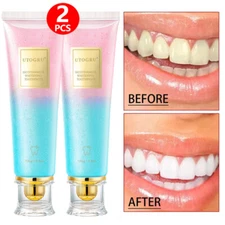 2PCS Niacinamide Whitening Toothpaste Nicotinamide Dazzling Whitening Toothpaste