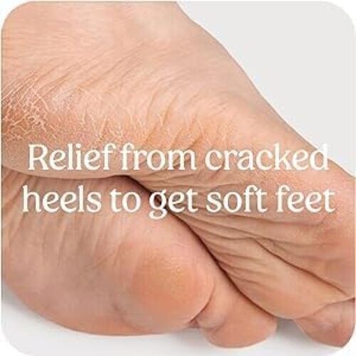 Foot Cream For Rough, Dry and Cracked Heel, Feet Cream For Heel Repair, 50g (1) - Picture 3 of 5